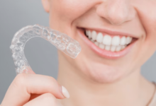 Clear Aligners