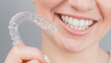 Clear Aligners