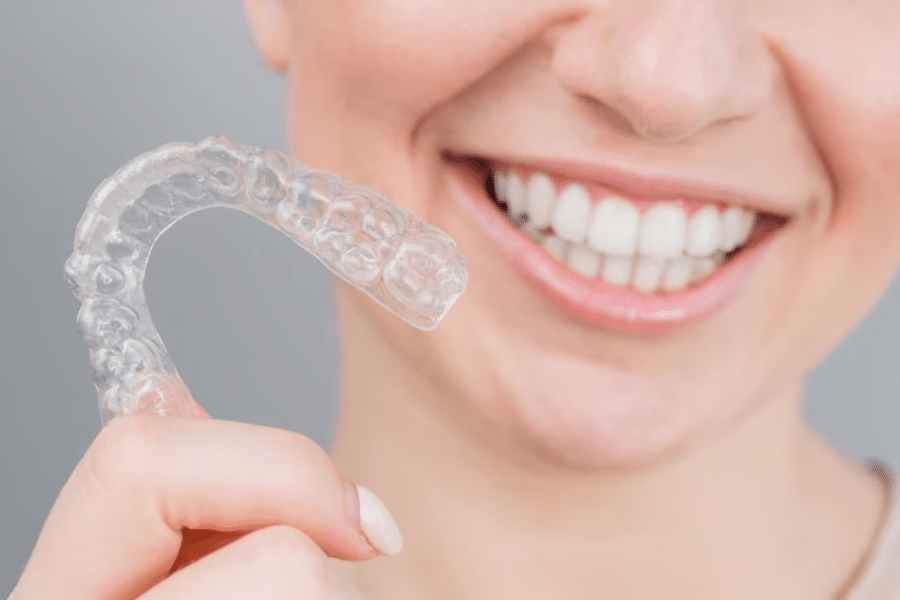 Clear Aligners